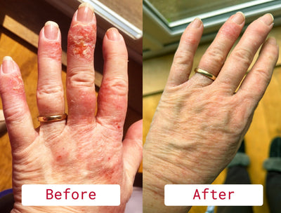 Nourish and Restore: The Best Caring Skincare for Sensitive and Dry Skin Relief