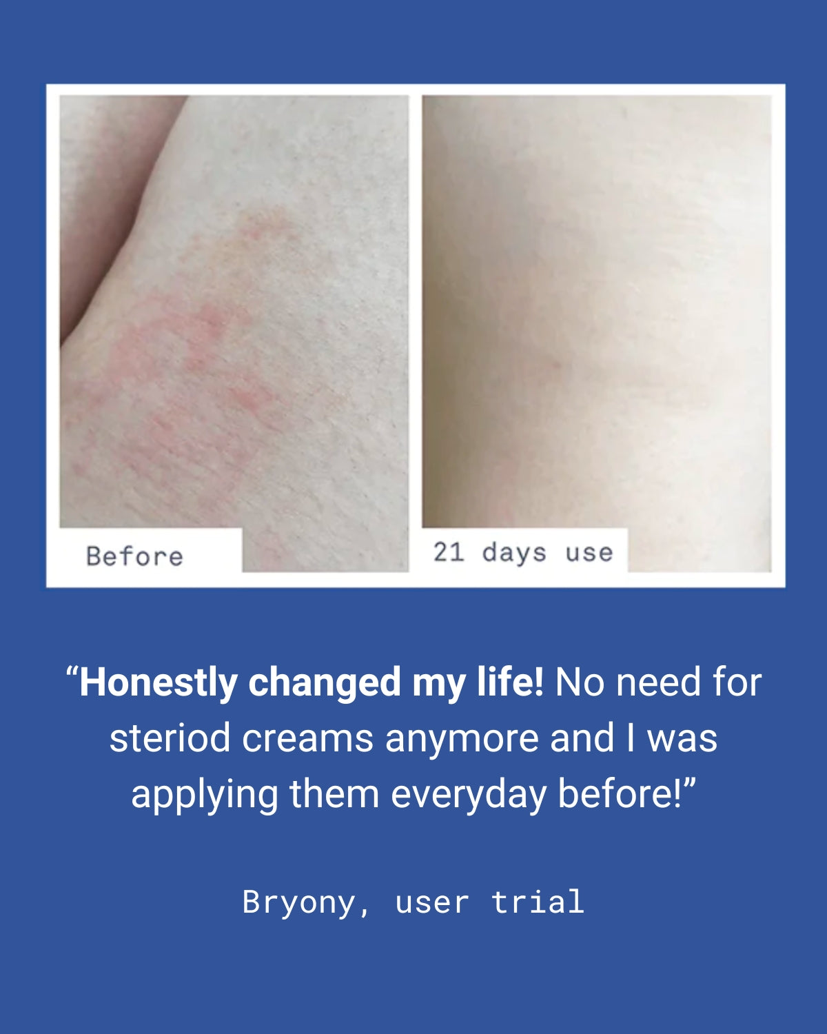 ULTRA CARING BODY BALM – 250ml