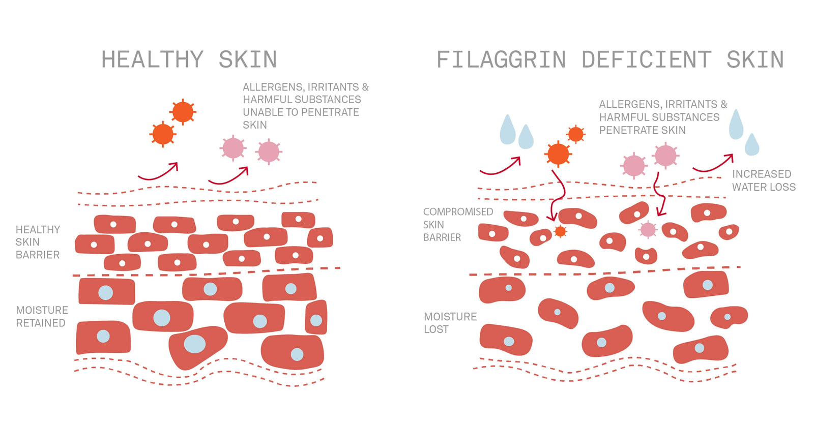 Filaggrin and eczema – Nursem Skincare