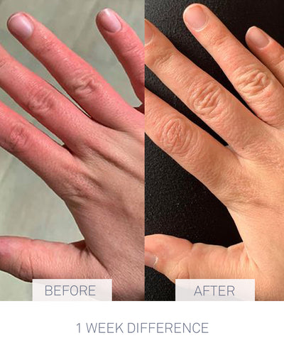 Nursem Caring Hand Cream before and after 