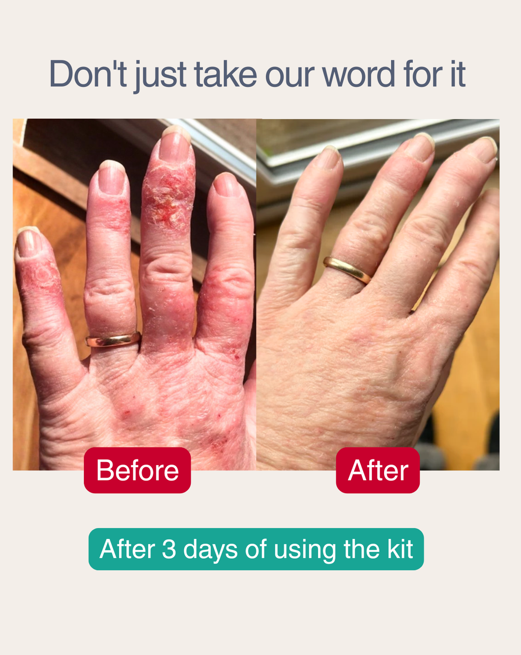 COMPLETE HANDCARE KIT