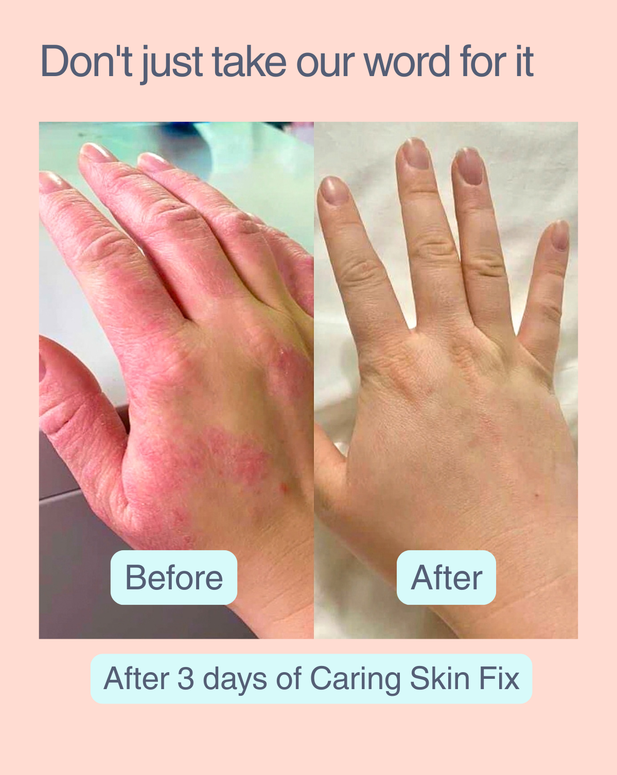 CARING SKIN FIX – 50ml