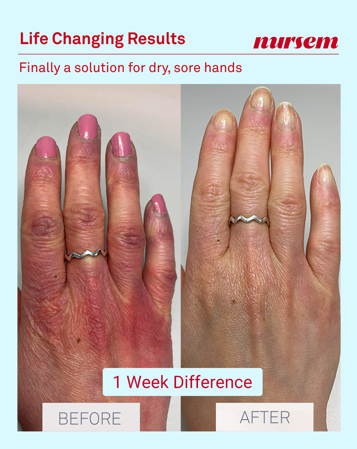 HANDCARE STARTER KIT