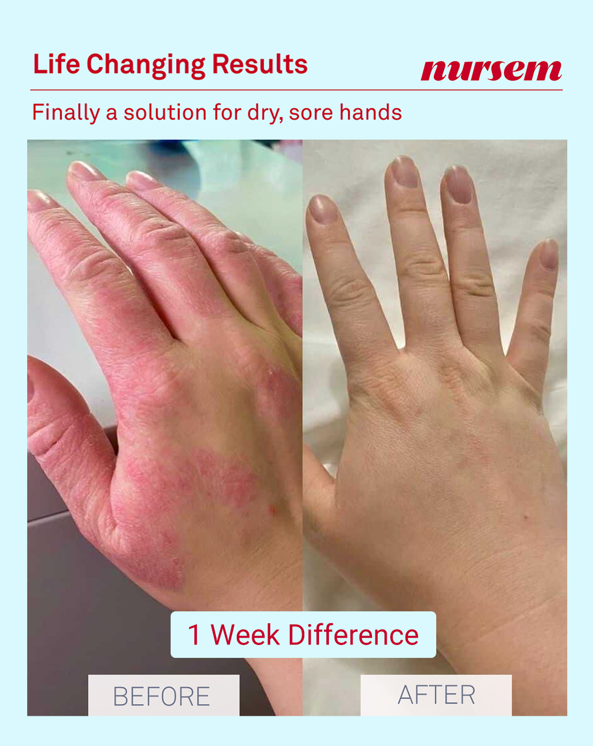 HANDCARE STARTER KIT