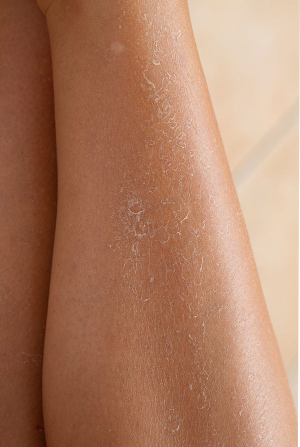 Dry skin